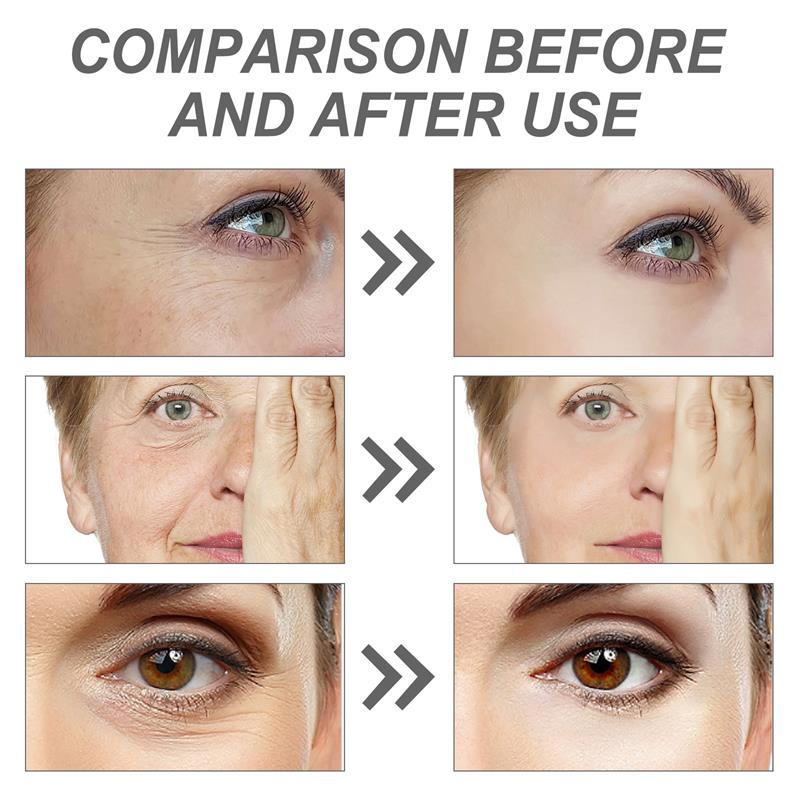 Retinol Remove Wrinkle Face Se - The Ordinary Serum Hyaluronic Acid recension och pris
